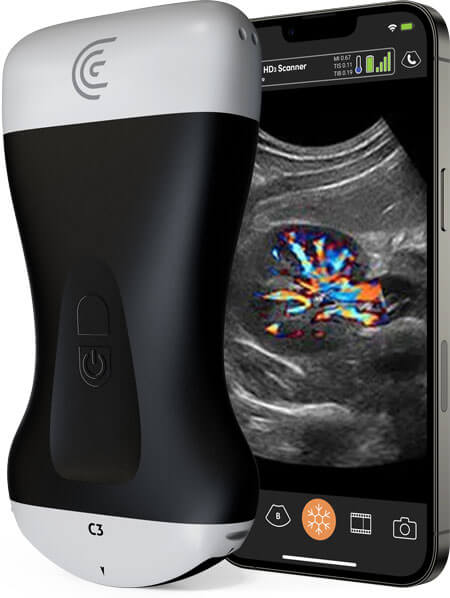 Clarius-Best-Portable-Ultrasound-Scanner